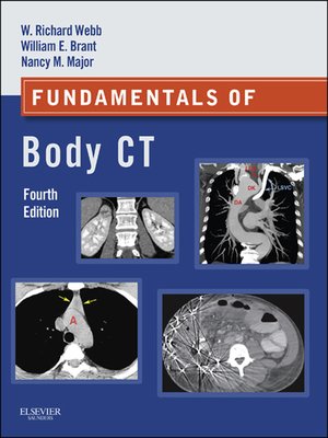 cover image of Fundamentals of Body CT E-Book